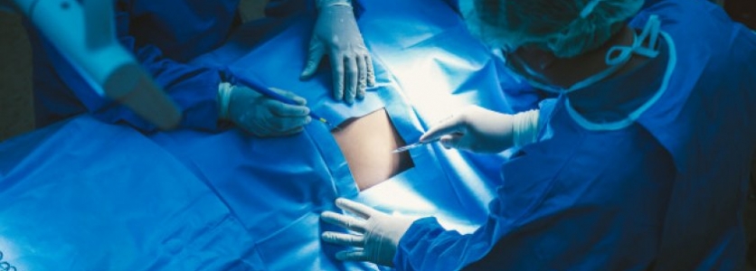 Laparoskopik Histerektomi