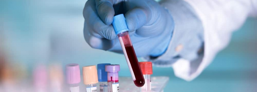 Gebelikte Torch Taraması