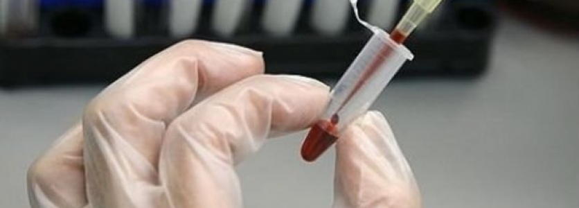 Gebelikte Üçlü Tarama Testi